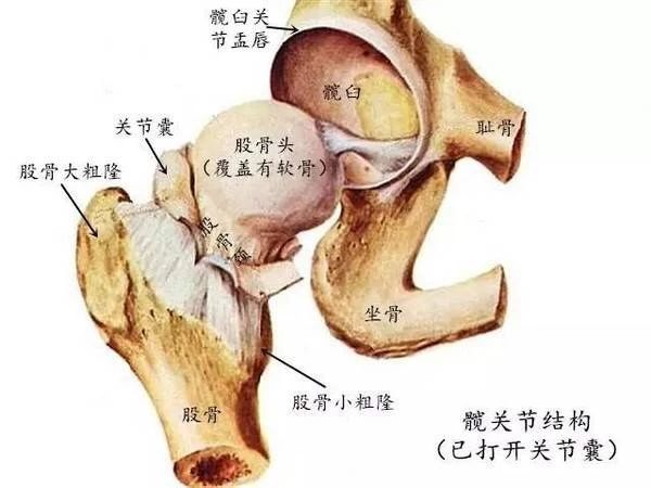 髋关节置换术的那些事儿